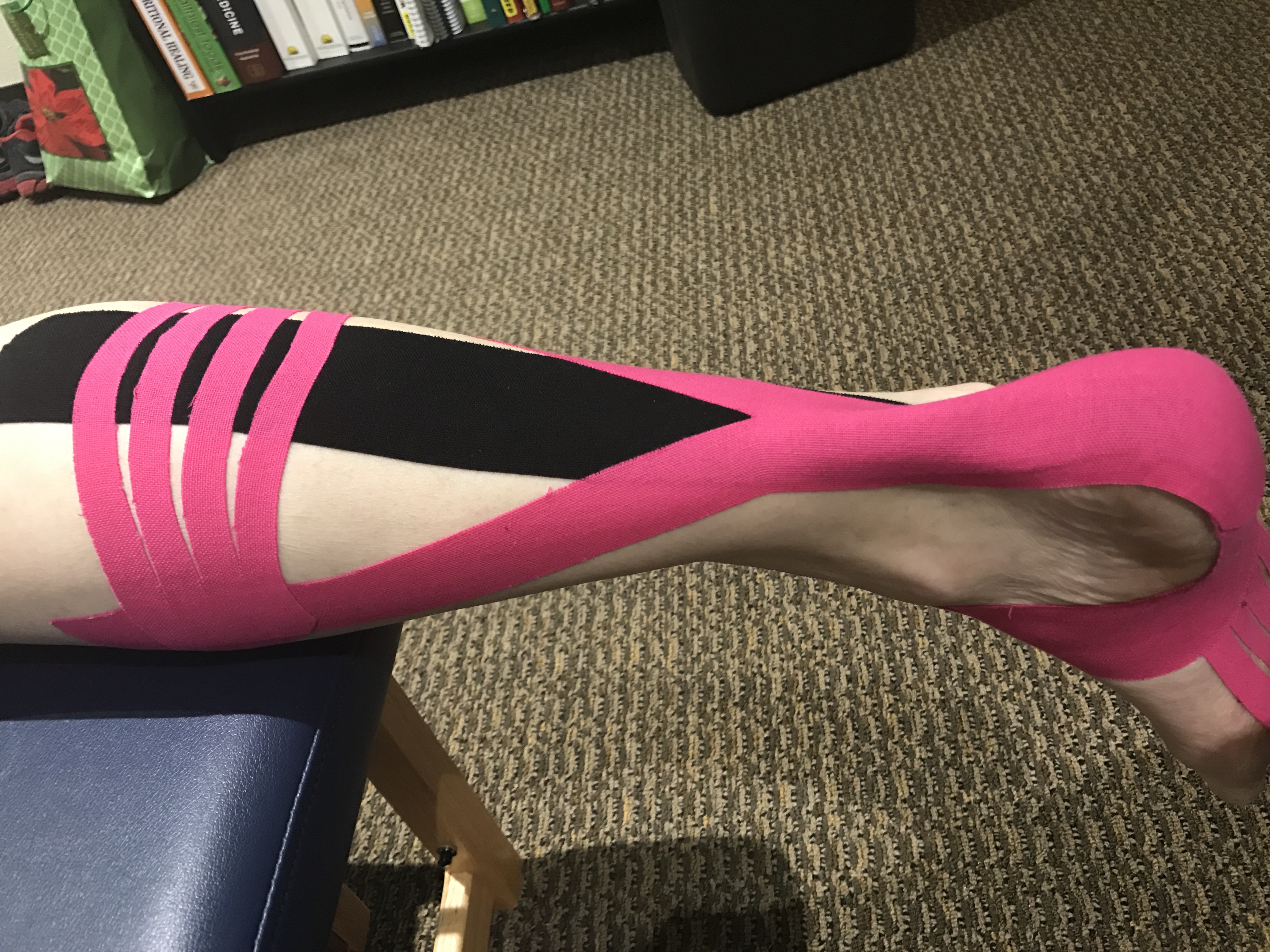 Achilles stabilization /calf strain