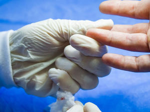 Parmak Tendon Ameliyatı Olanların Yorumları