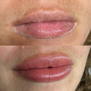 Lip Blush Healing Process: What to Expect Day by Day