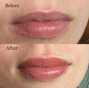 Lip blush results in Round Rock, TX