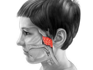 Carne esponjosa ou adenoide: sinais de alerta, diagnóstico e tratamento