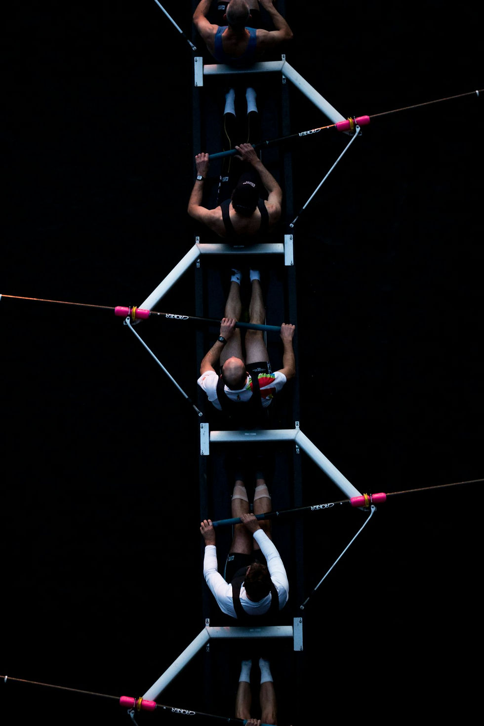 Living With Hypermobility: Why Your Joints Hurt and How Physical Therapy Helps