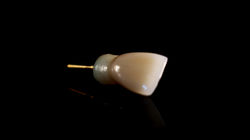 Central superior Metal-Cerámica