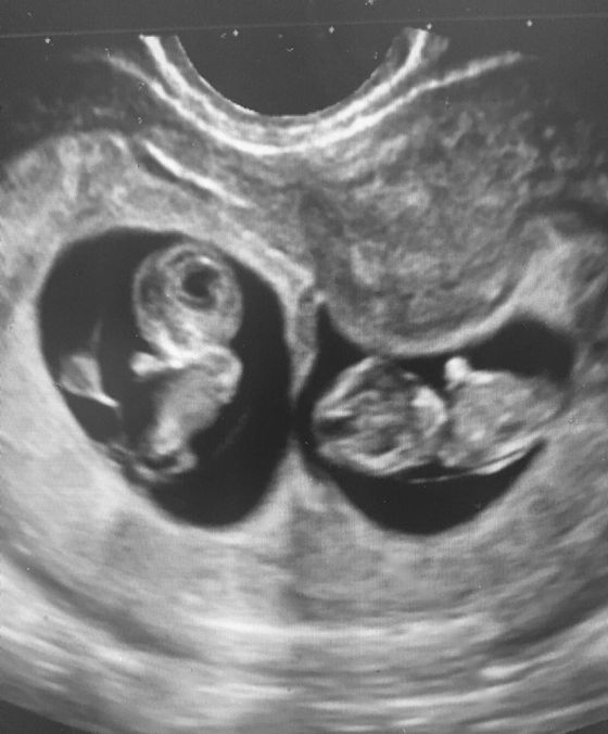 Finding out there's two