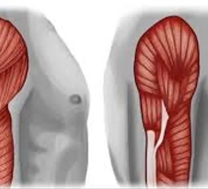 Hipertrofia cardíaca silenciosa en culturistas jóvenes: el riesgo que no da síntomas