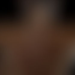 ¿Por qué ya no respondes igual a los ciclos? El impacto de la edad en los receptores androgénicos