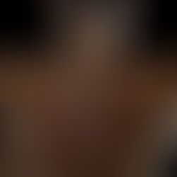 ¿Por qué ya no respondes igual a los ciclos? El impacto de la edad en los receptores androgénicos