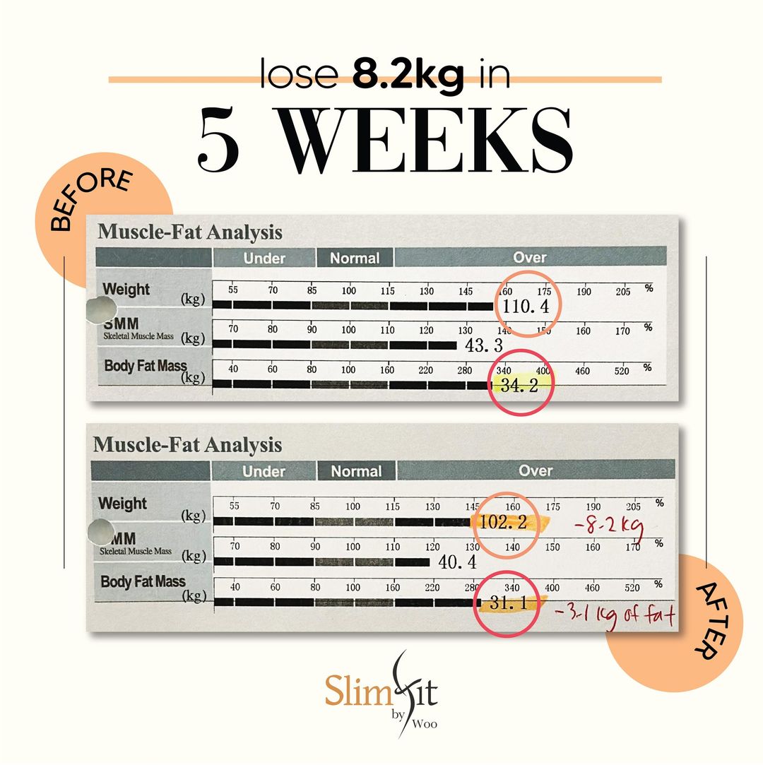 Indiba Slimming Selangor Treatment