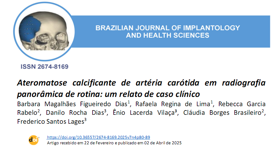 Novo artigo publicado na Brazilian Journal of Implantology and Health Sciences