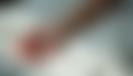 Understanding the Impact and Signs of Physical Abuse