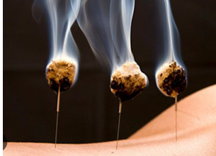 Exploring the Ancient Art of Moxibustion