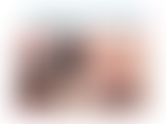 牙 齒矯正器的四大種類