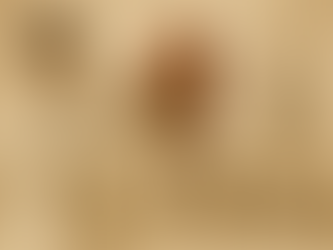 The Diagnostic Trap of Monoclonal Gammopathy of Renal Significance (MGRS): A Kidney First Approach