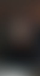 JA, TUDI TELO ŽALUJE