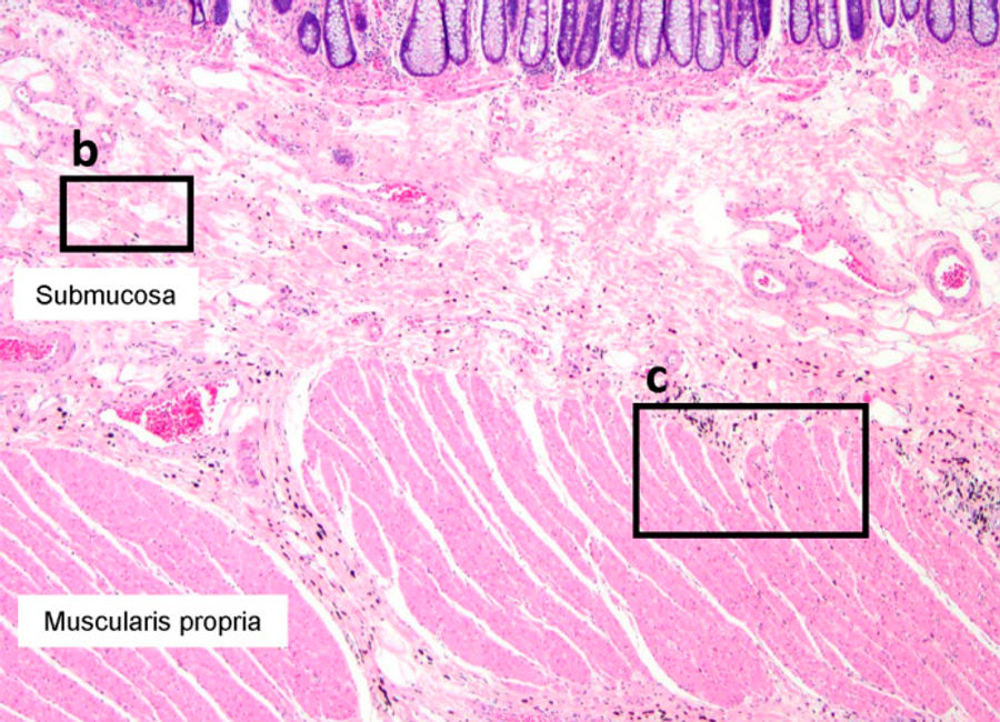 Dispersed tattoo ink showing the continuity of the interstitium within and between organs in the colon