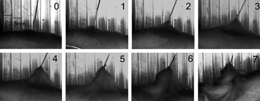 Connective tissue whorl forming around an acupuncture needle in rat subcutaneous tissue as rotations increase from zero to seven