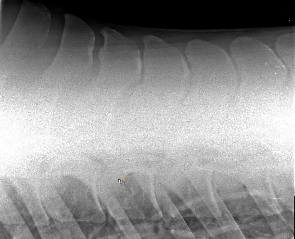 Röntgen Kissing Spines BWS