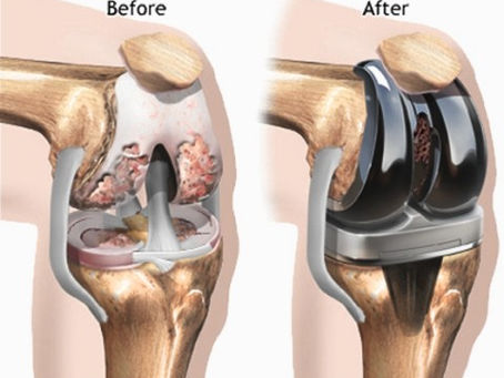 The Ball is Rolling....