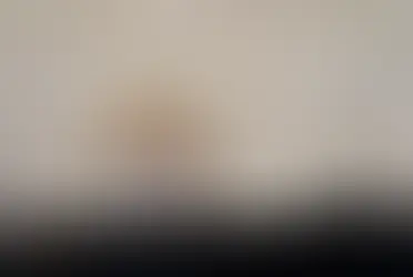 metal destekli porselen diş