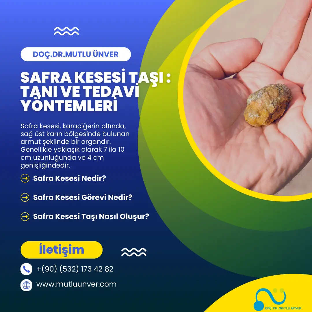 Safra kesesi taşı : tanı ve tedavi yöntemleri