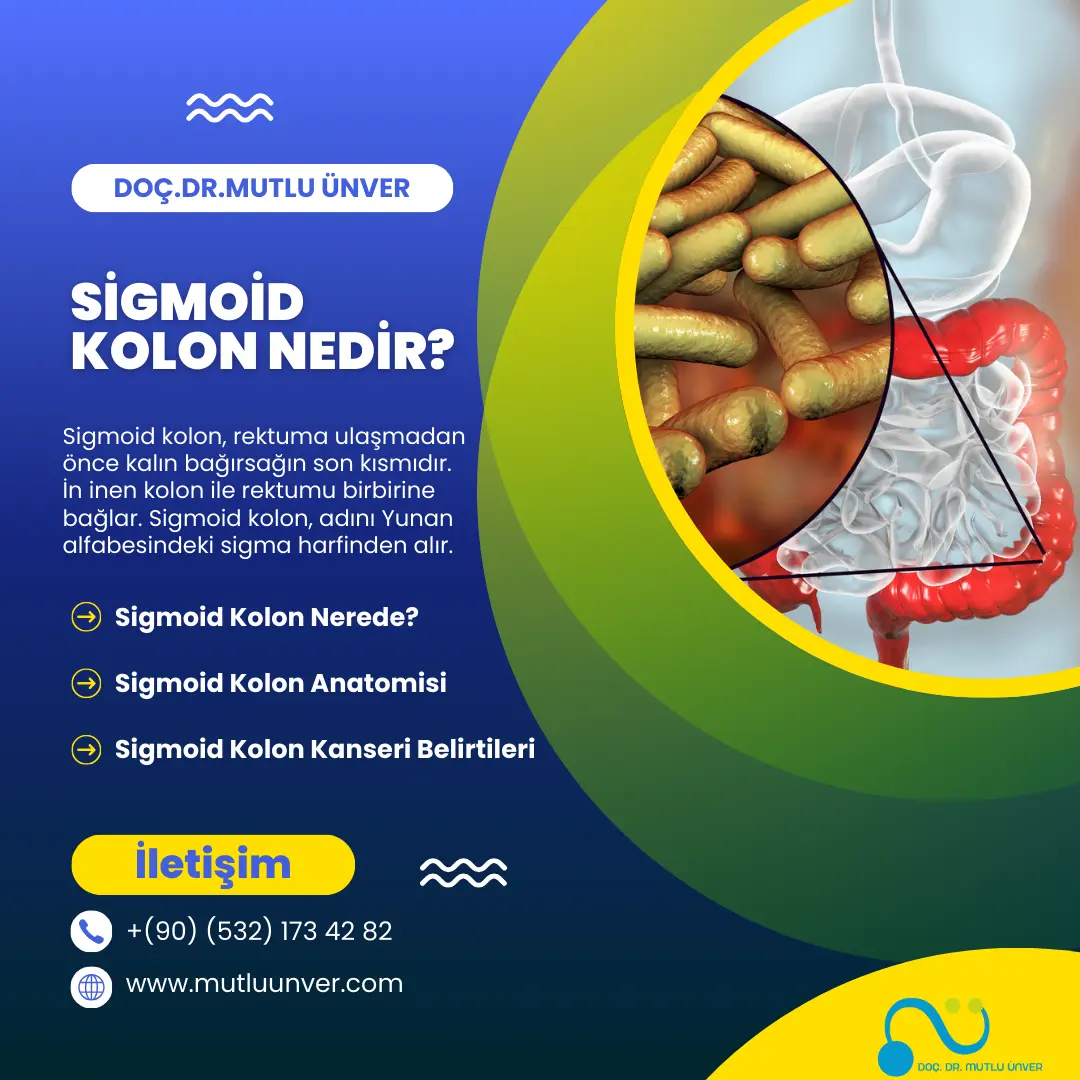 Sigmoid Kolon Nedir?