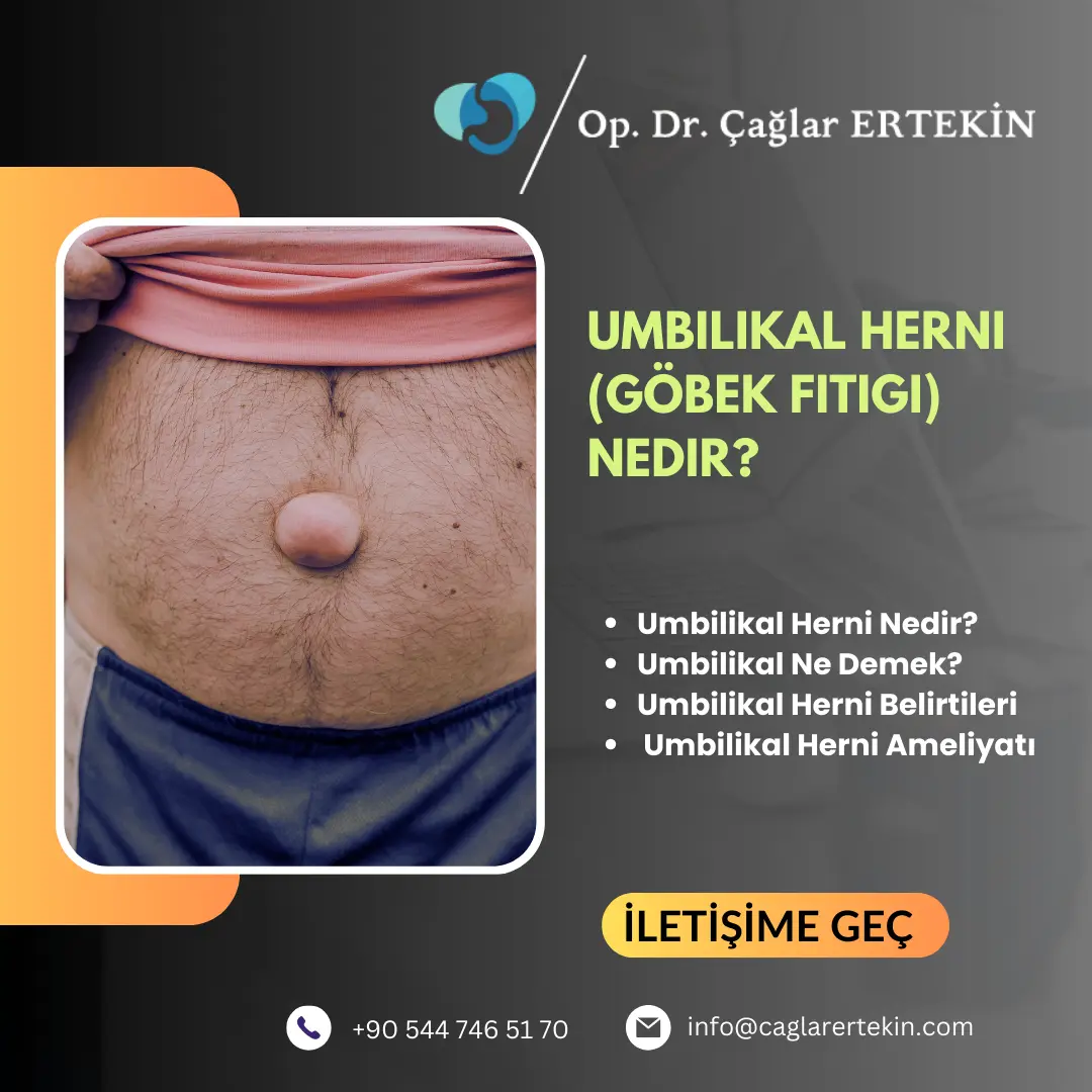 üst karın fıtığı belirtileri