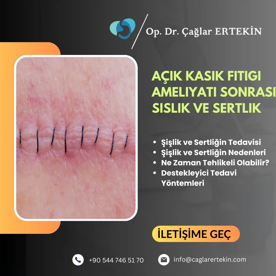 Stoma Fıtığı Belirtileri