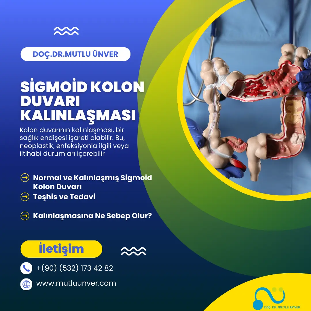 Sigmoid Kolon Duvarında Kalınlaşma