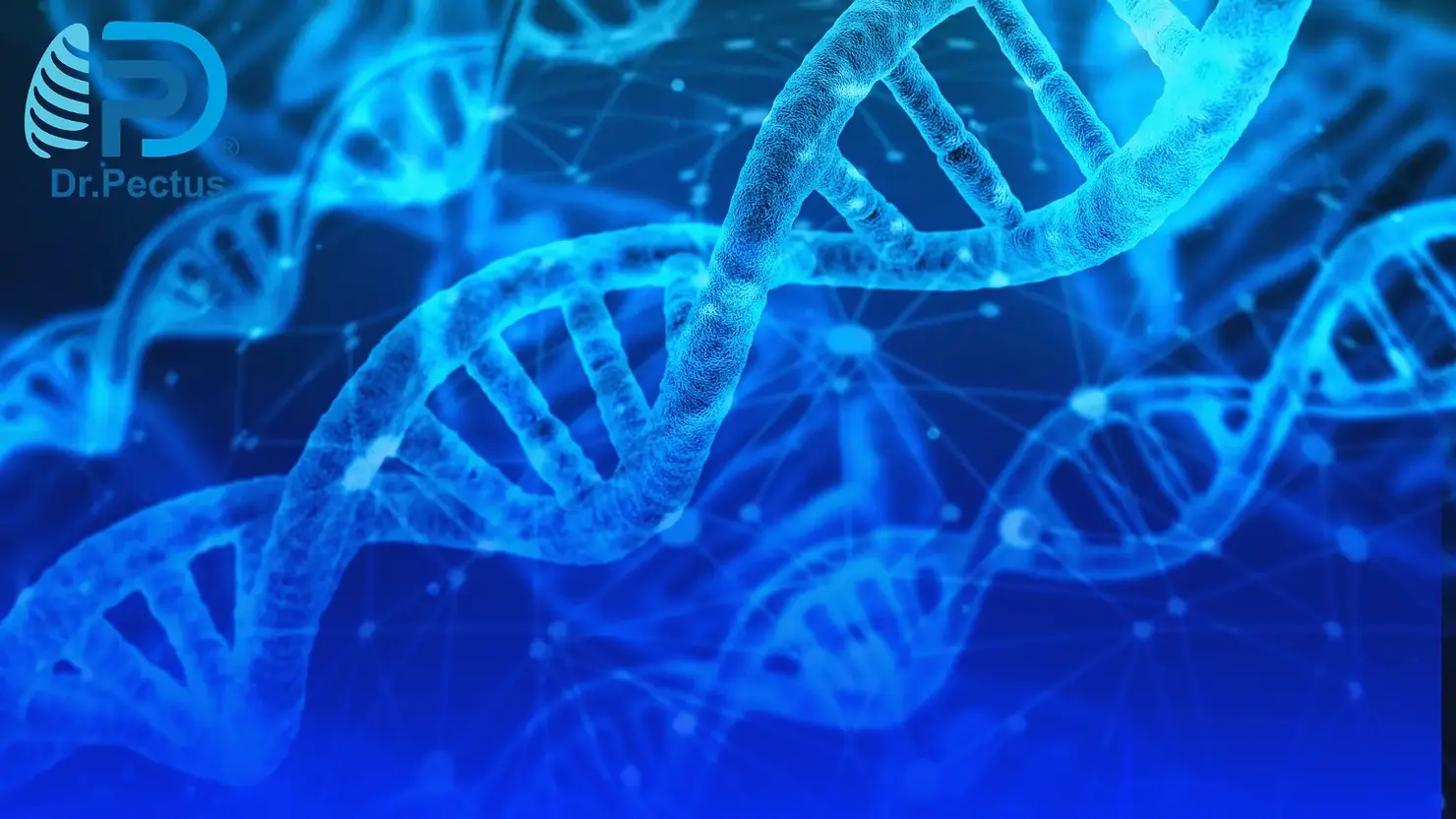Pectus Excavatum and genetic