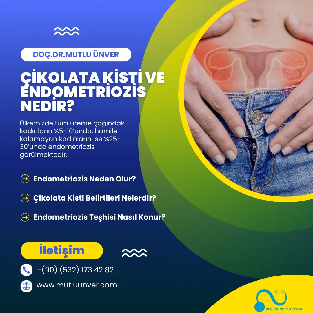 Çikolata Kisti ve Endometriozis