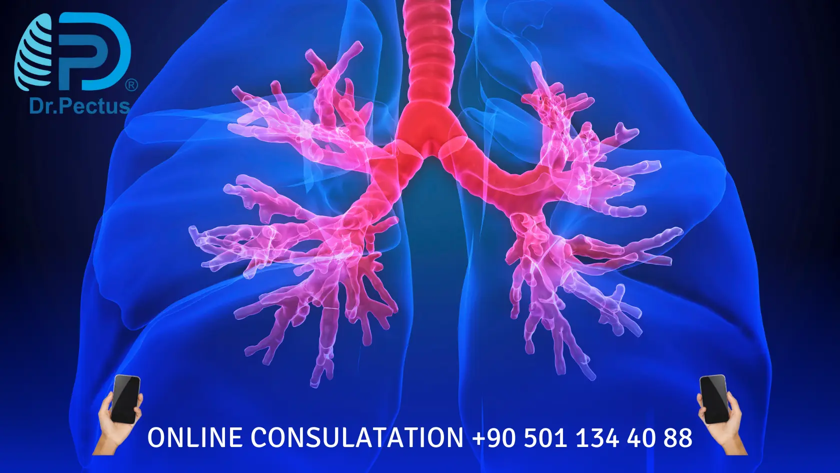 Pectus Excavatum (Sunken Chest) Causes and Risk Factors