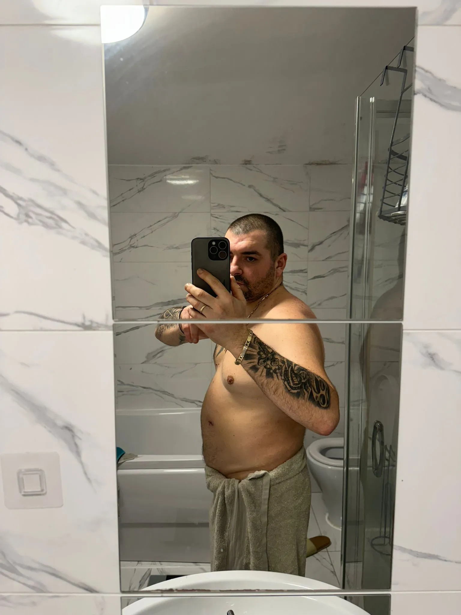 weight loss surgery cost