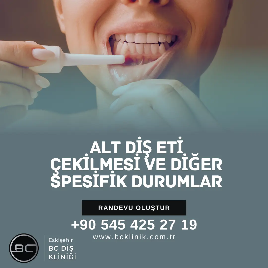 Alt Diş Eti Çekilmesi - diş eti çekilmesi kadınlar kulübü