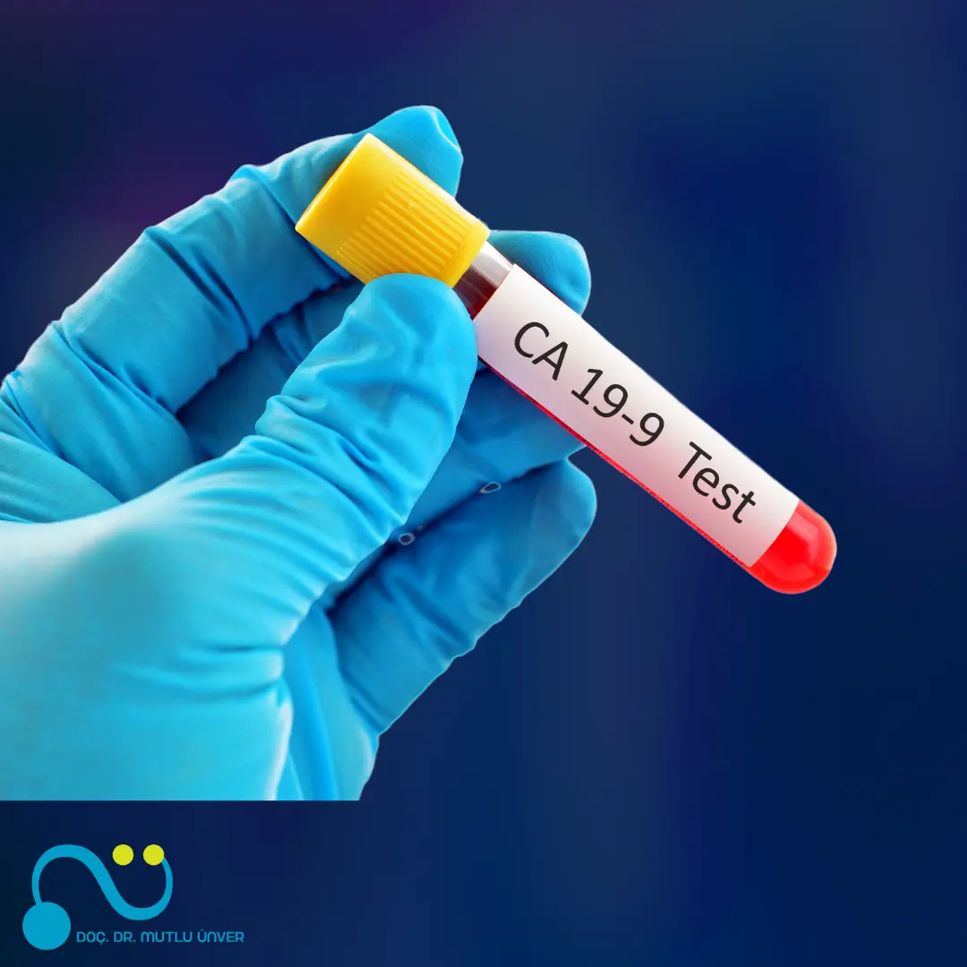 What Is Colon Cancer Symptoms And Treatment Methods Assoc Prof Dr what-is-colon-cancer-symptoms-and-treatment-methods-assoc-prof-dr