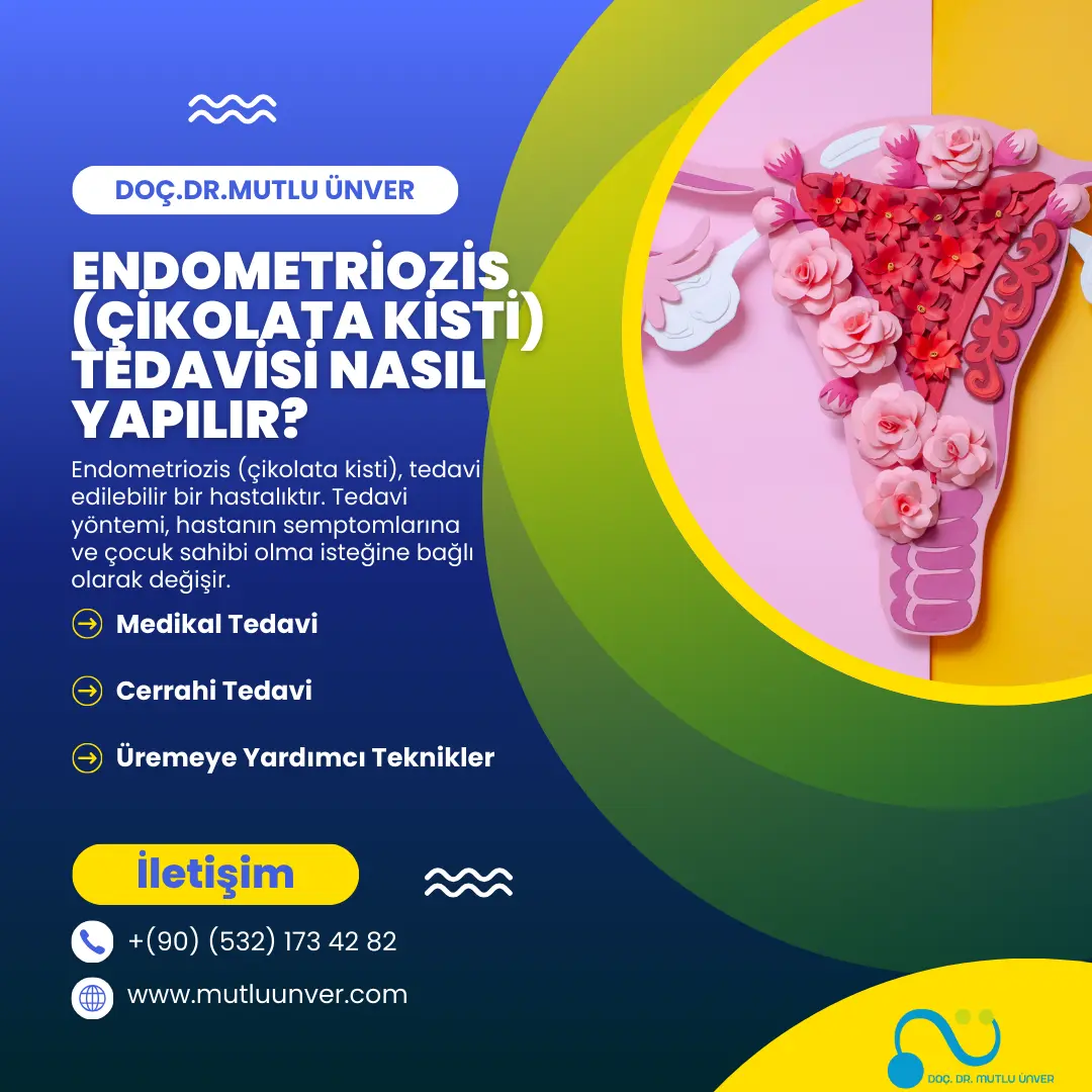 Endometriozis (Çikolata Kisti) Tedavisi Nasıl Yapılır?