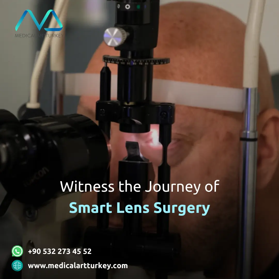  disadvantages of lens replacement surgery