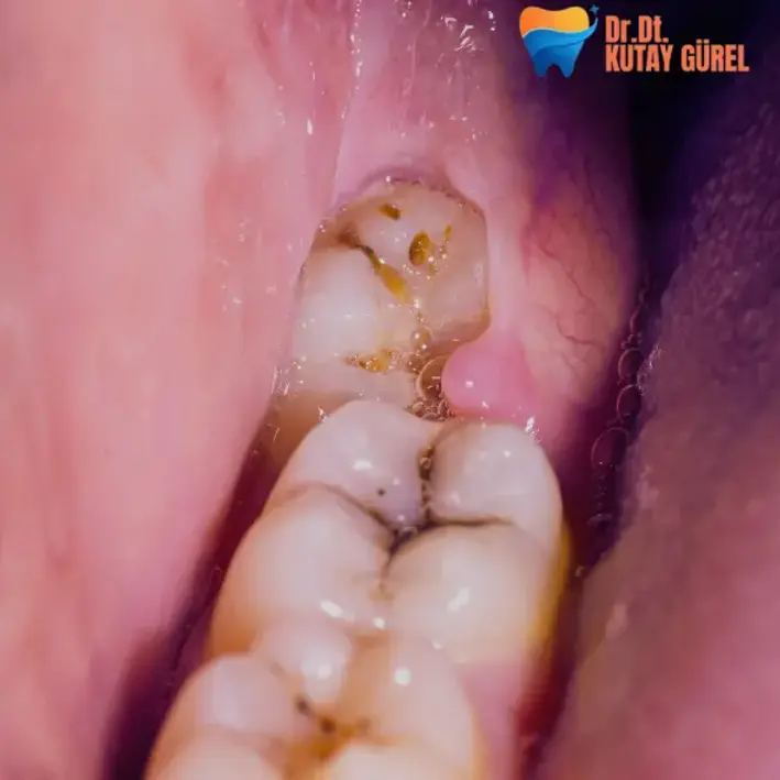 20 lik diş izmir, çiğli