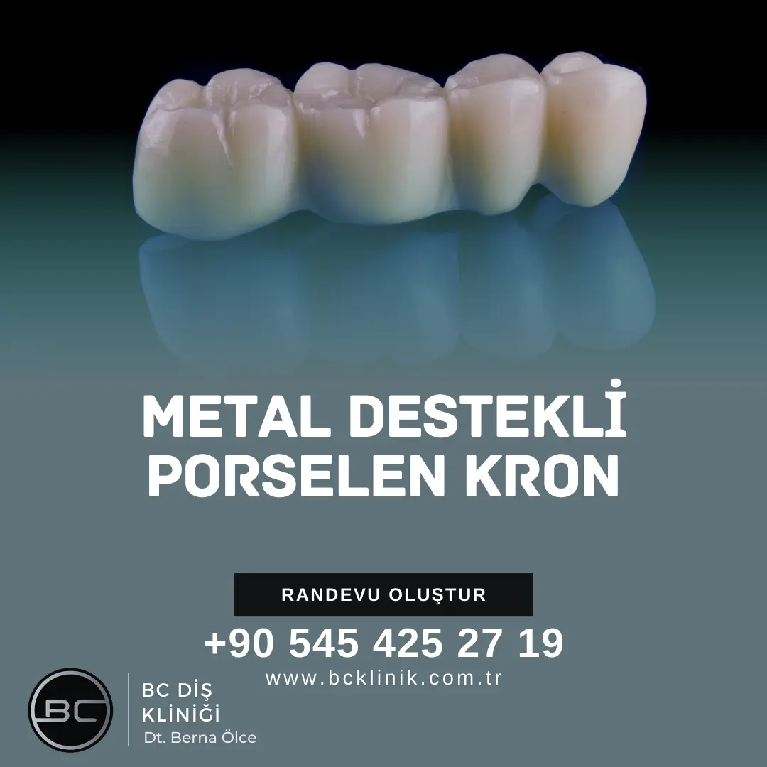 ayrık diş (diastema) tedavisi