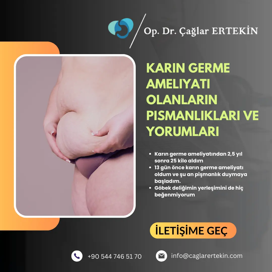  izmir mini karın germe