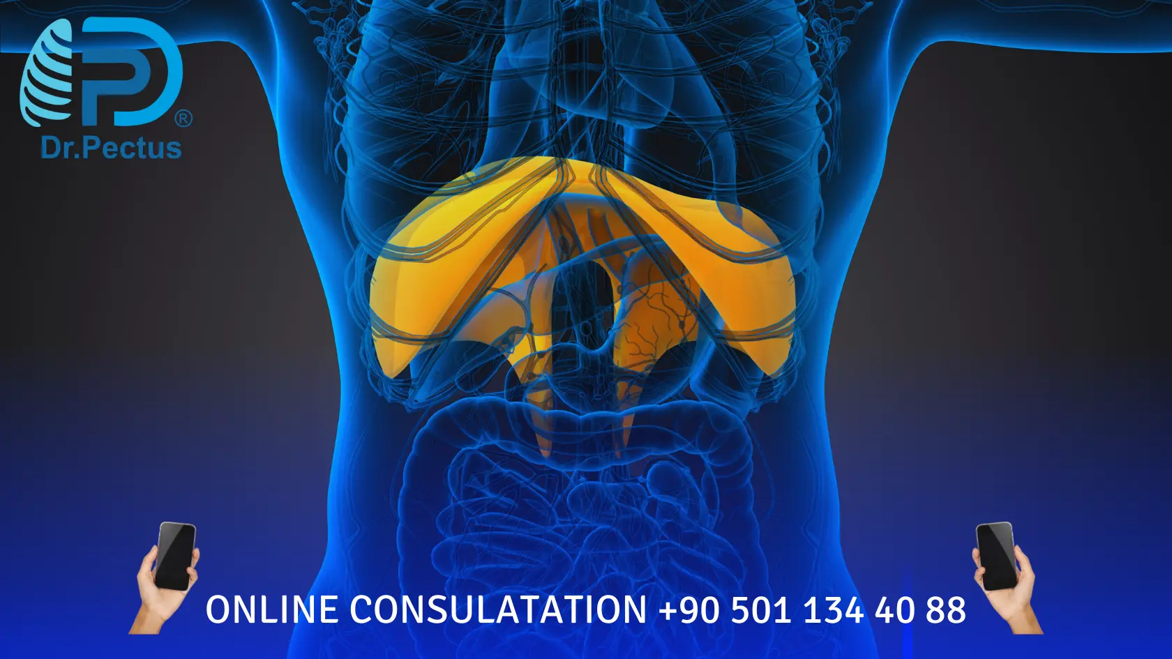 Pectus Excavatum (Sunken Chest) Causes and Risk Factors