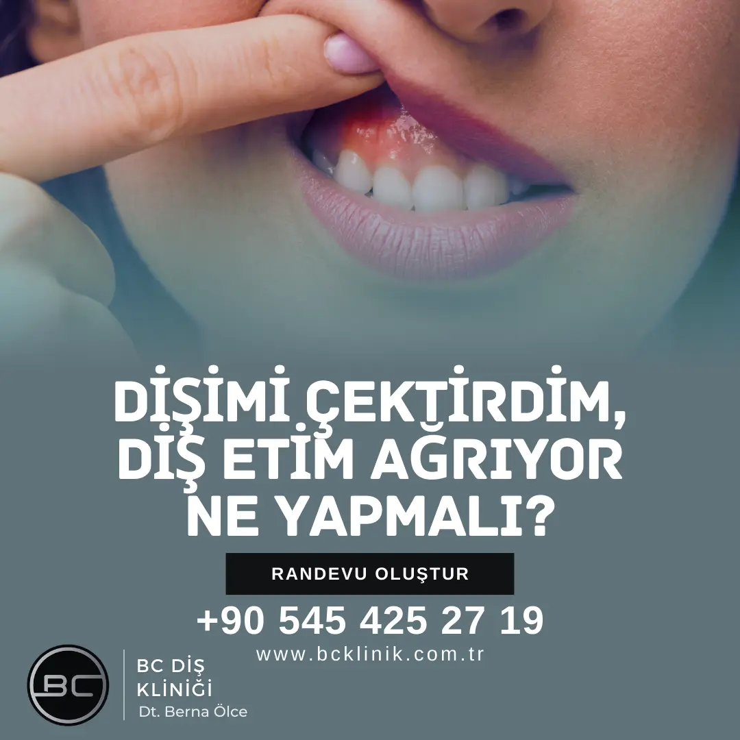 Dişimi Çektirdim, Diş Etim Ağrıyor Ne Yapmalı?