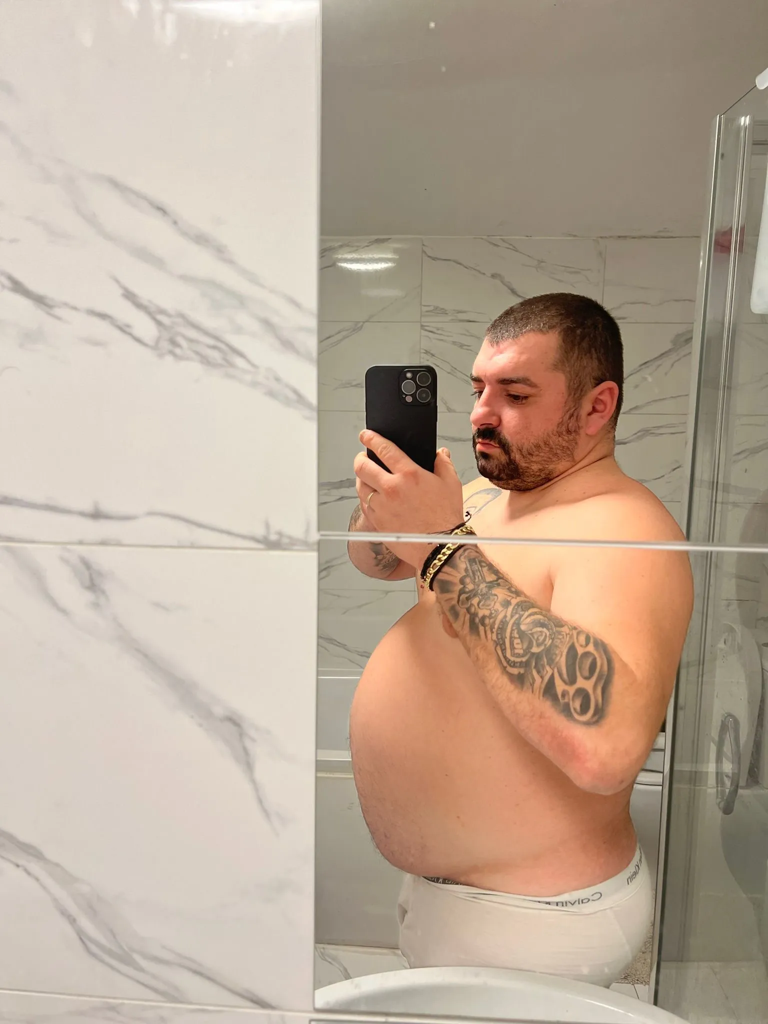 weight loss surgery cost in Turkey