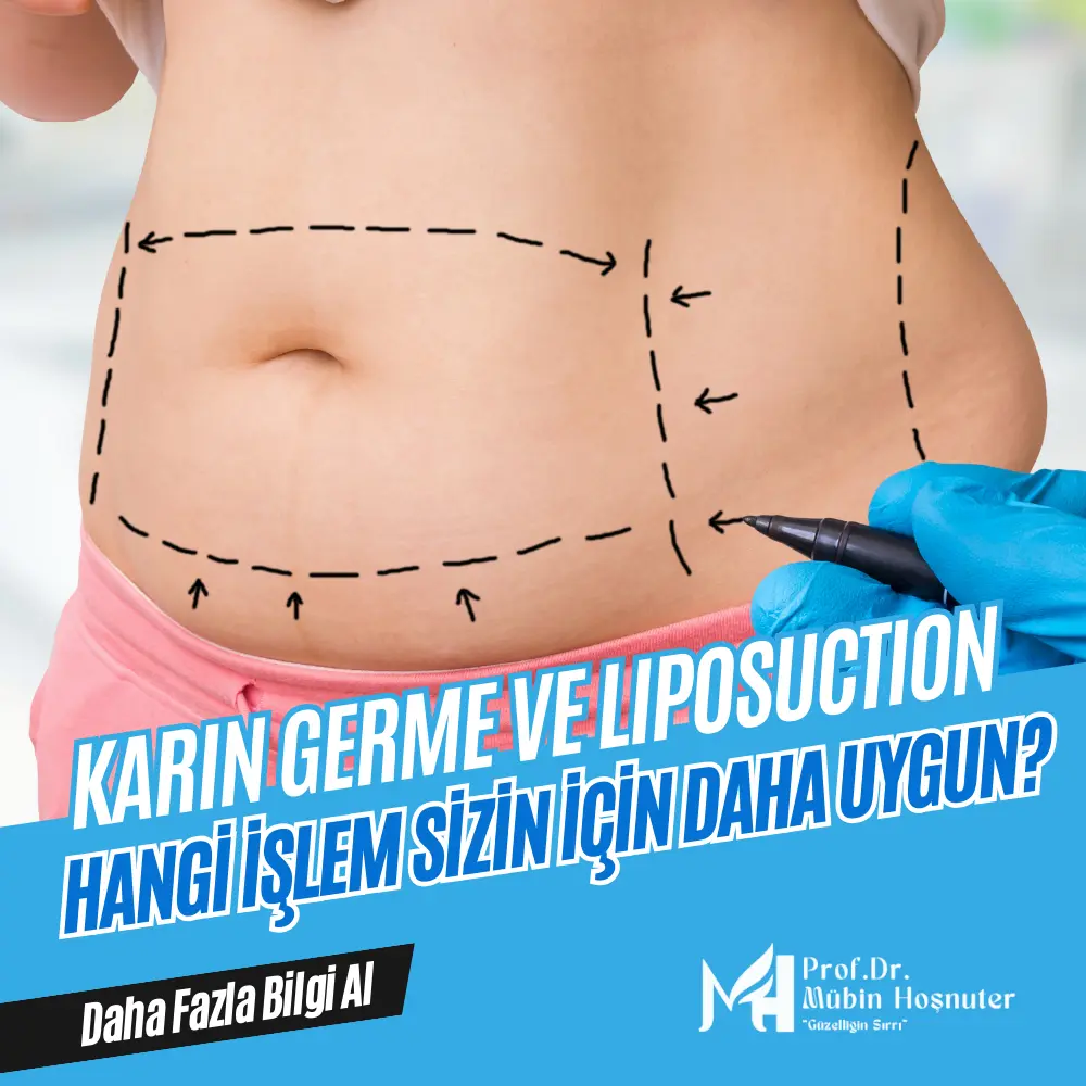 Karın Germe ve Liposuction