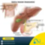 Safra Yolu Kanseri belirtileri - safra yolu kanseri 4.evre yaşam süresi