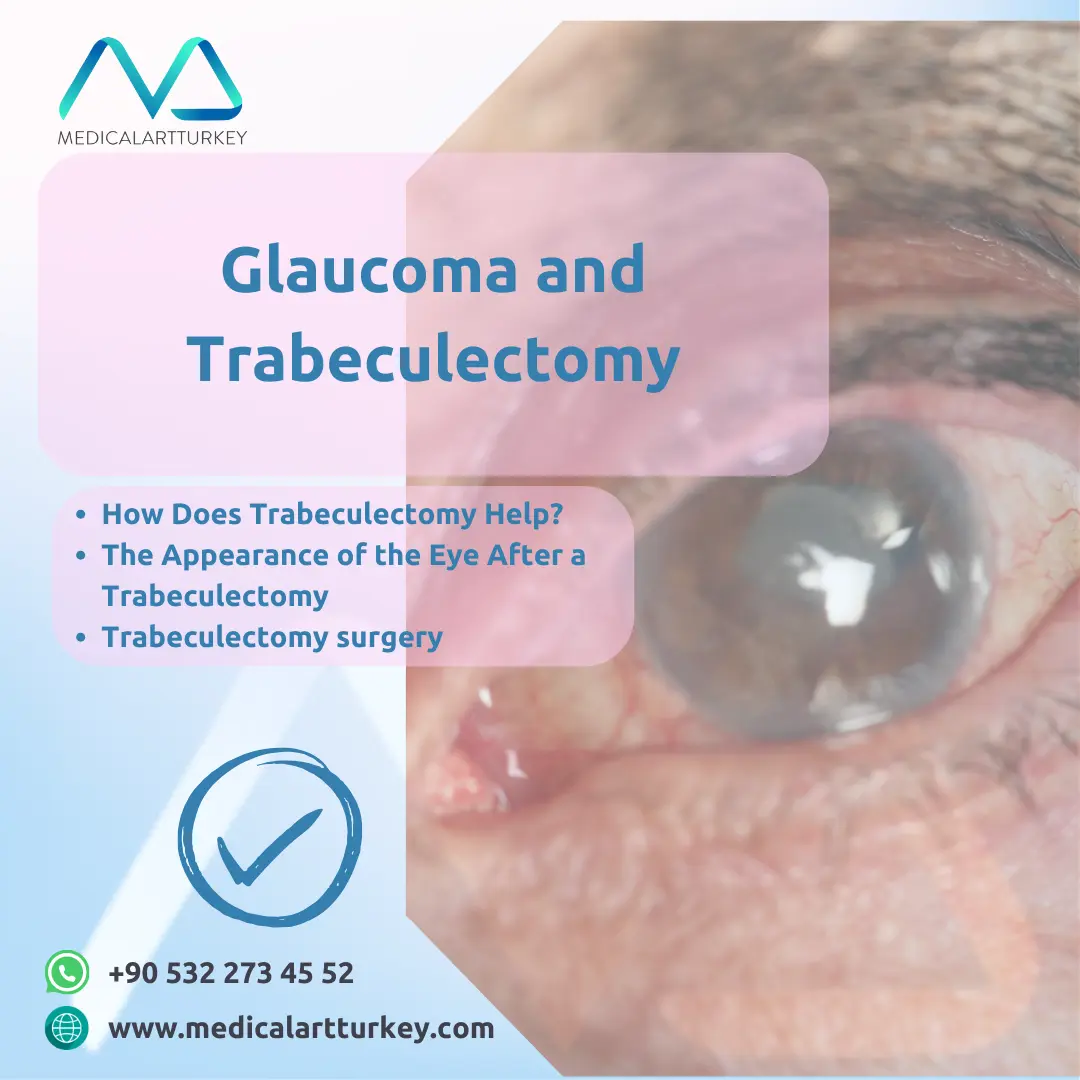 refractive lens exchange risks