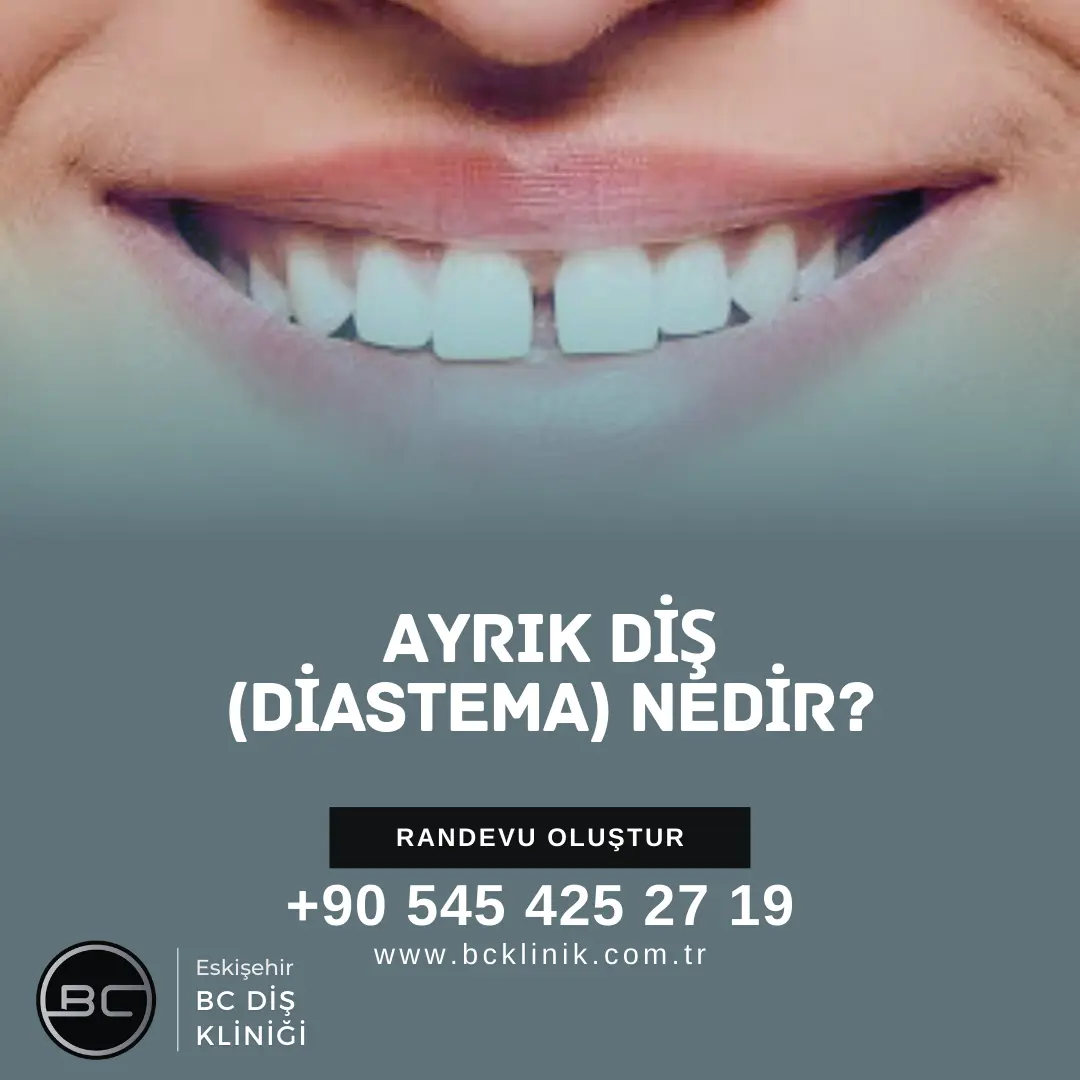 diş taşı temizliği