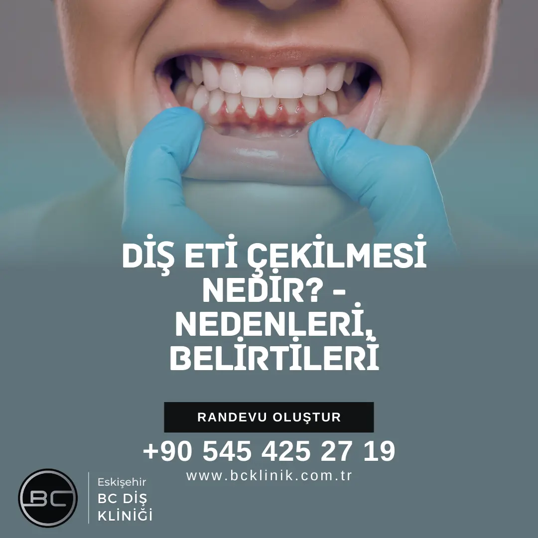 Diş Eti Çekimesi Belirtileri ve Nedenleri