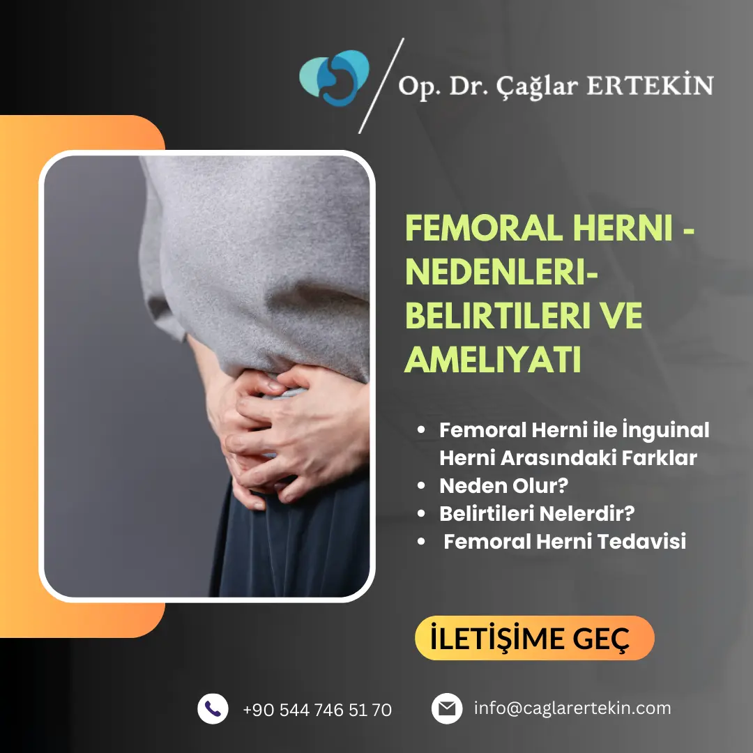 üst karın fıtığı belirtileri