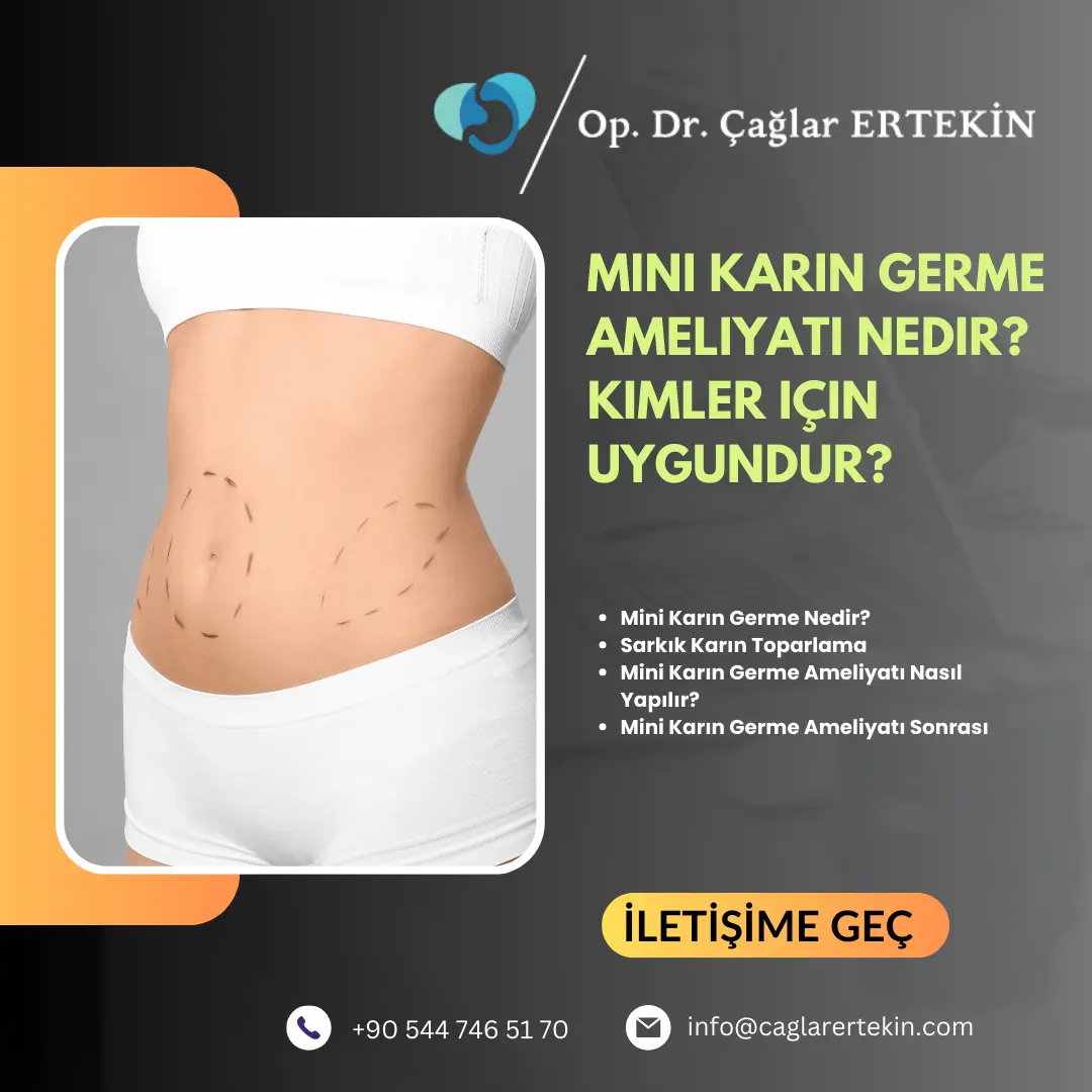 Sigmoid kolon kitle ne demek