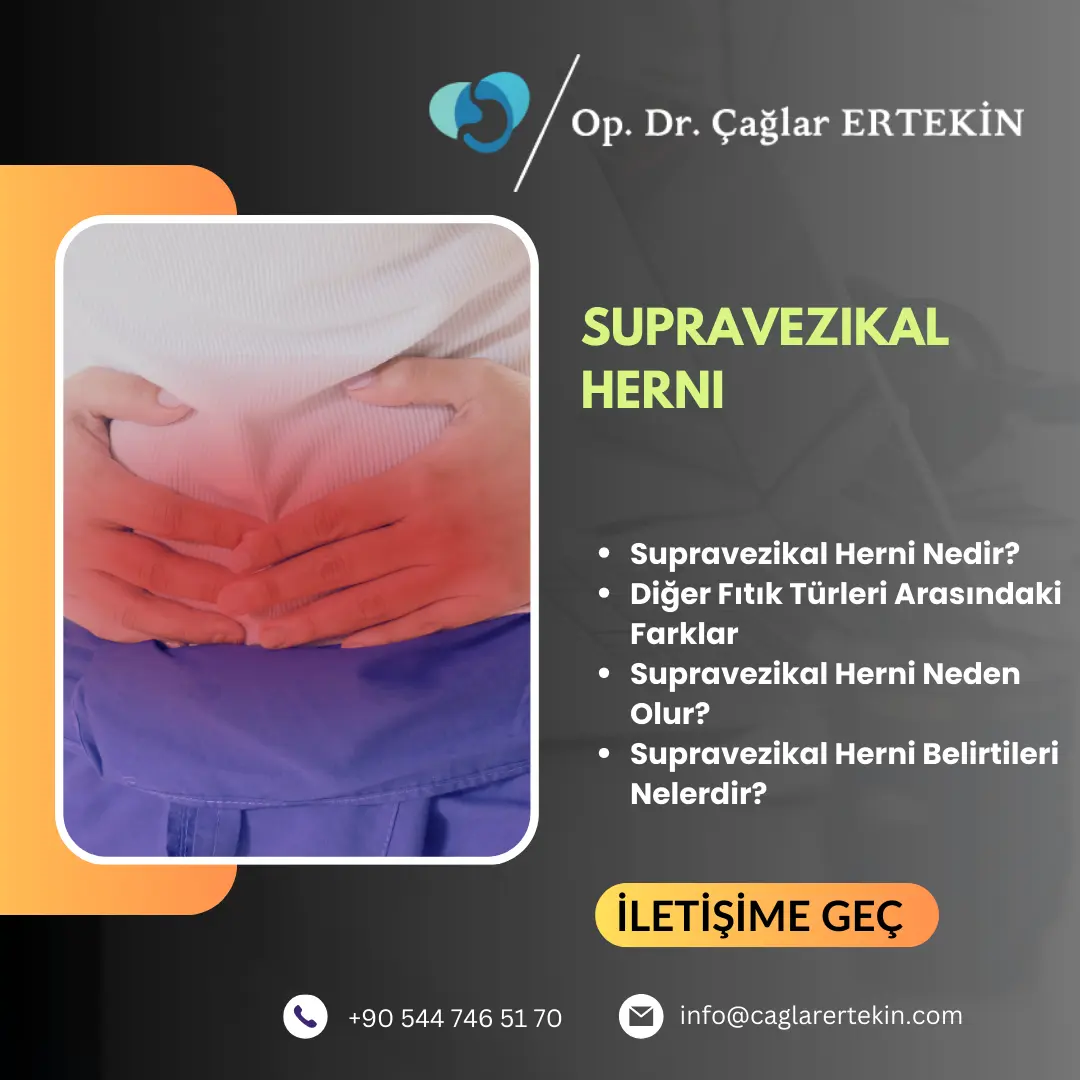 üst karın fıtığı belirtileri